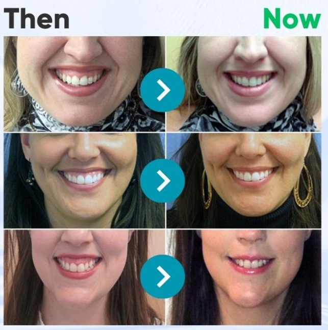 VioCore Bee Venom Dental Treatment Toothpaste